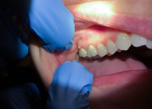 Best Emergency Cosmetic Dentistry (e.g., broken veneers) in Mechanicsburg, PA