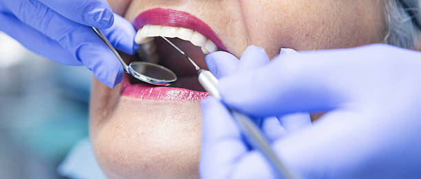 Best Dental Abscess Treatment in Mechanicsburg, PA